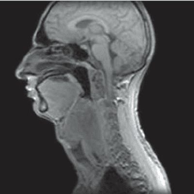 МРТ мягких тканей шеи снимки